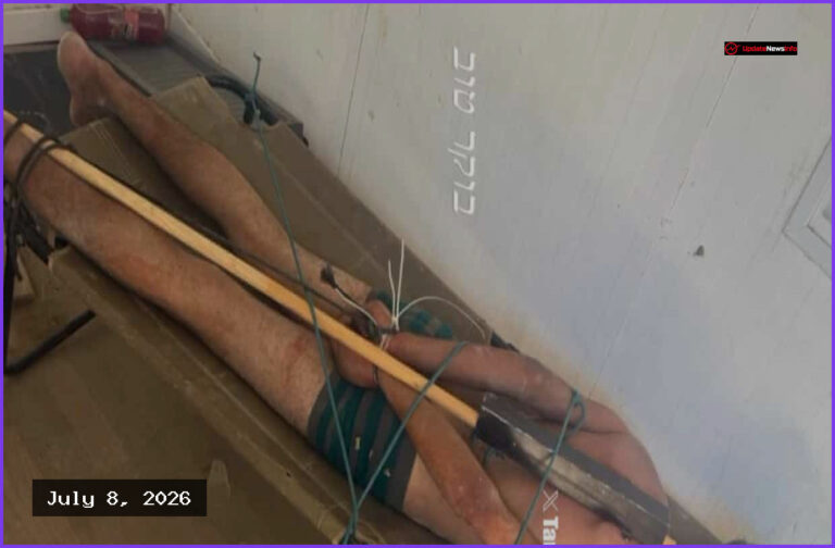 Rights Groups Say Viral Photo Confirms Israeli Torture Reports
